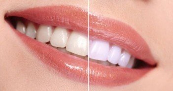 Natural Ways To Make Your Teeth Whiter At Home