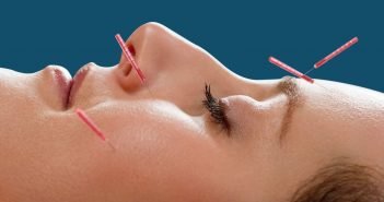 Acupuncture 101: What Happens To The Body With This Treatment?