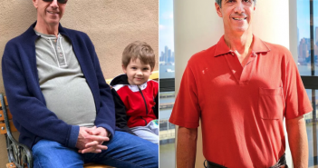 Man’s ‘Belly Fat’ Actually Turned Out to Be a 30-Pound Tumor