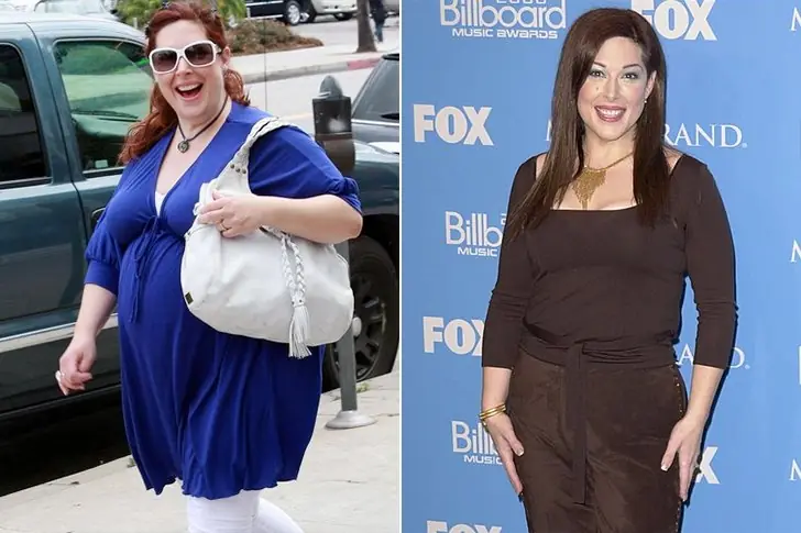 Carnie Wilson – 150lbs – Gastric Bypass Surgery &  Lap-Band Surgery